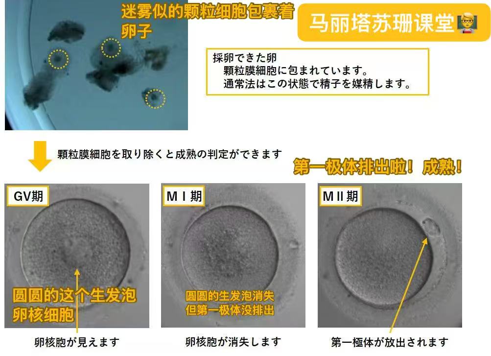 《取卵遇到空卵泡？先别慌！一文讲清原因与应对》 - militta